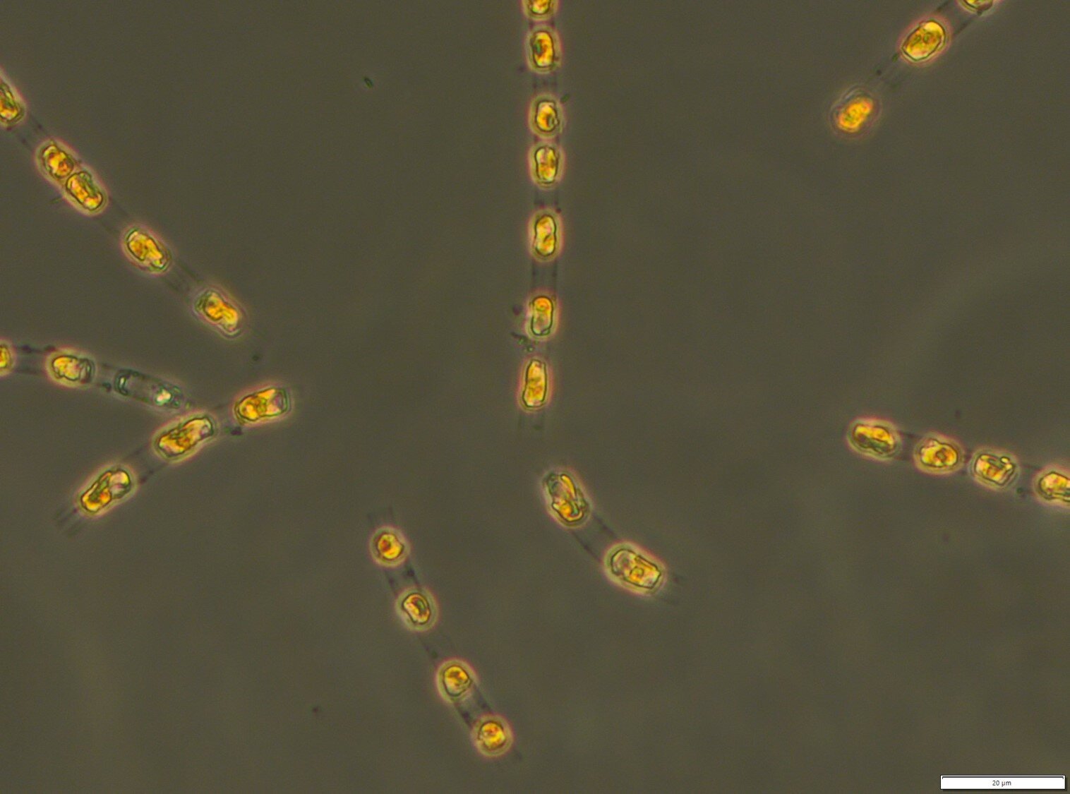 Ученые «разбудили» 7000-летние водоросли со дна Балтийского моря