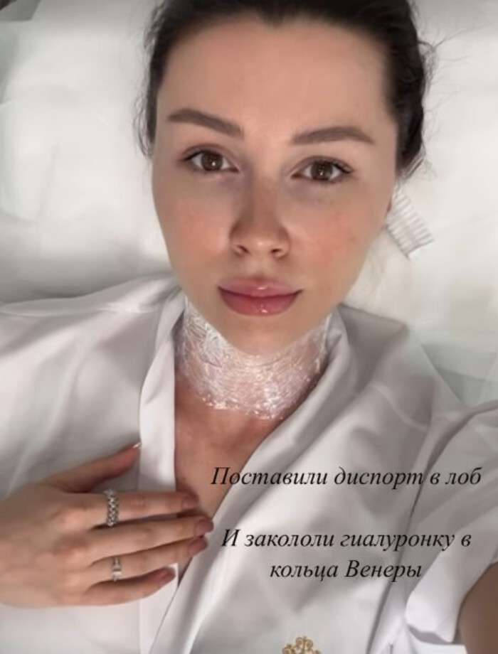 «Буду пугать прохожих»: Анна Заворотнюк вколола ботокс через 20 дней после родов «Буду пугать прохожих»: Анна Заворотнюк вколола ботокс через 20 дней после родов